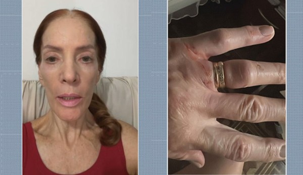 Médica agredida em assalto em São Paulo recebe alta e planeja mudar rotina de 15 anos: ‘Agora, tenho medo’