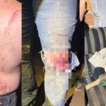 Suspeito de homicídio em Catalão é preso em Uberlândia após caso de sequestro e tortura